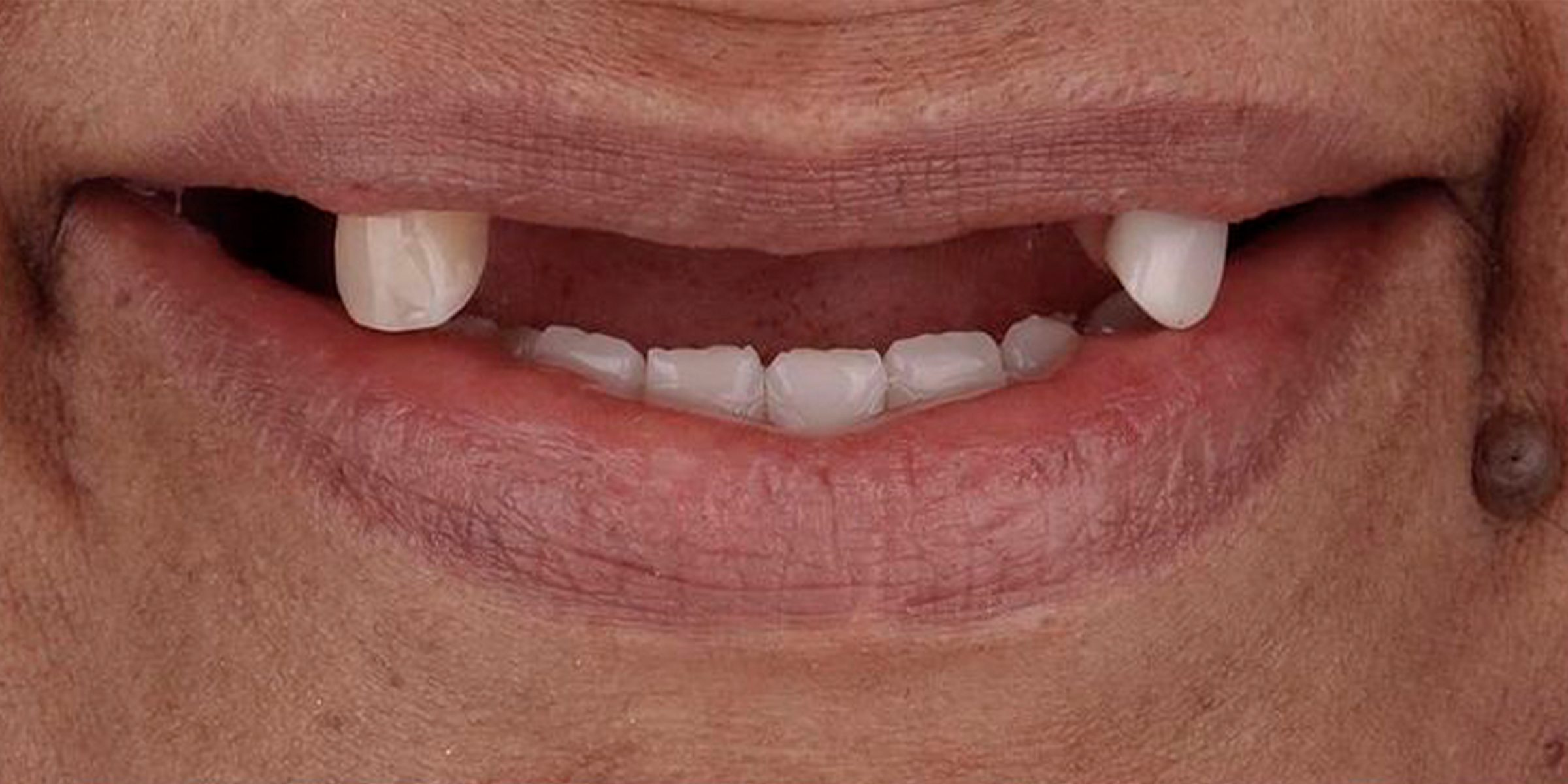 Close-up of man showing his teeth