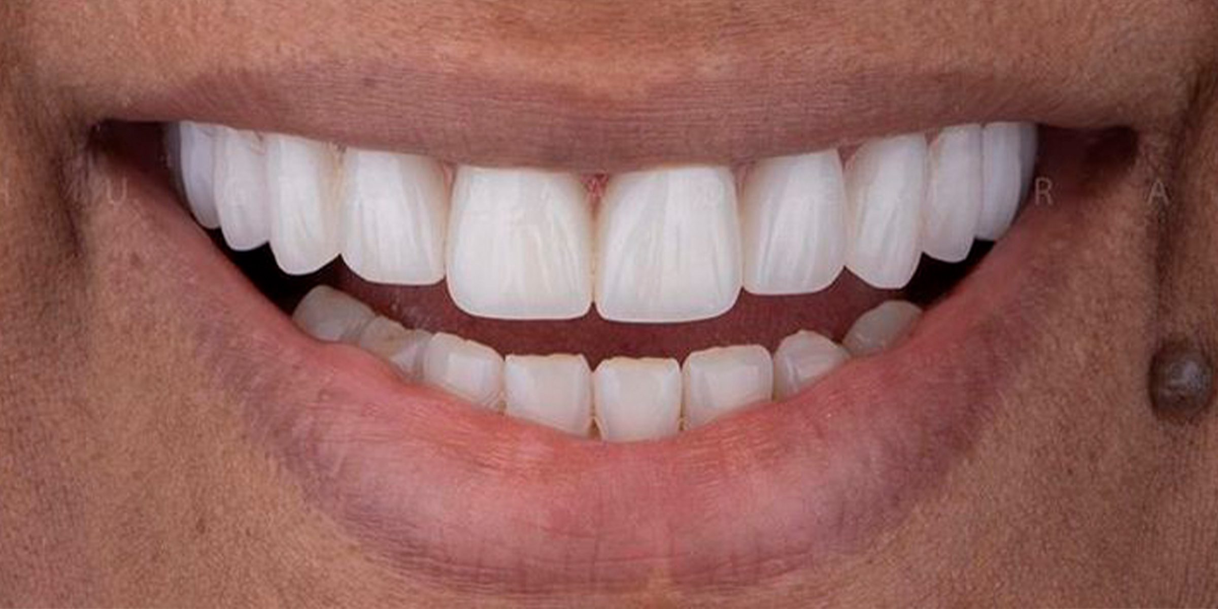 Close-up of man showing his teeth