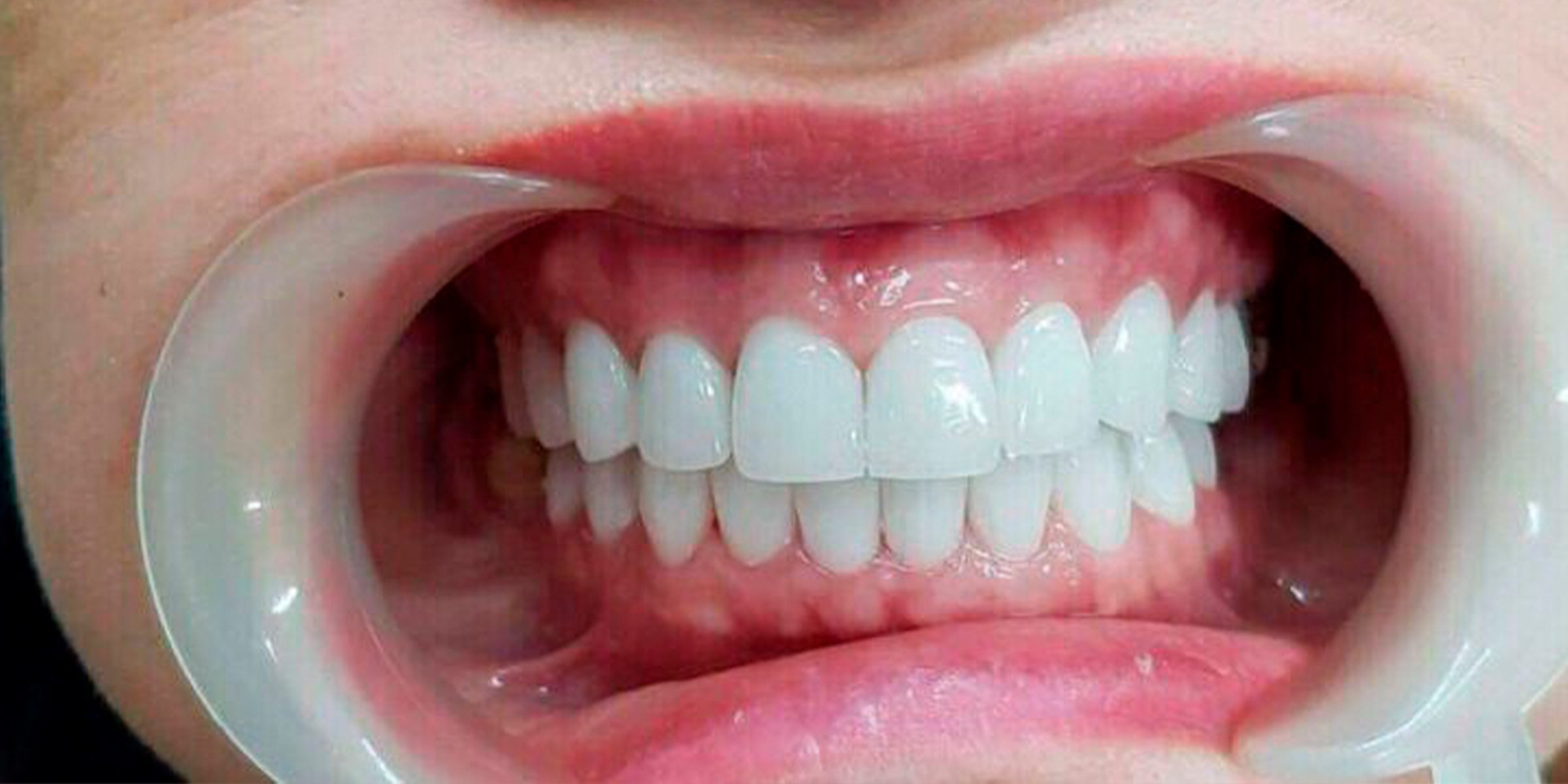 Close-up of man showing his teeth